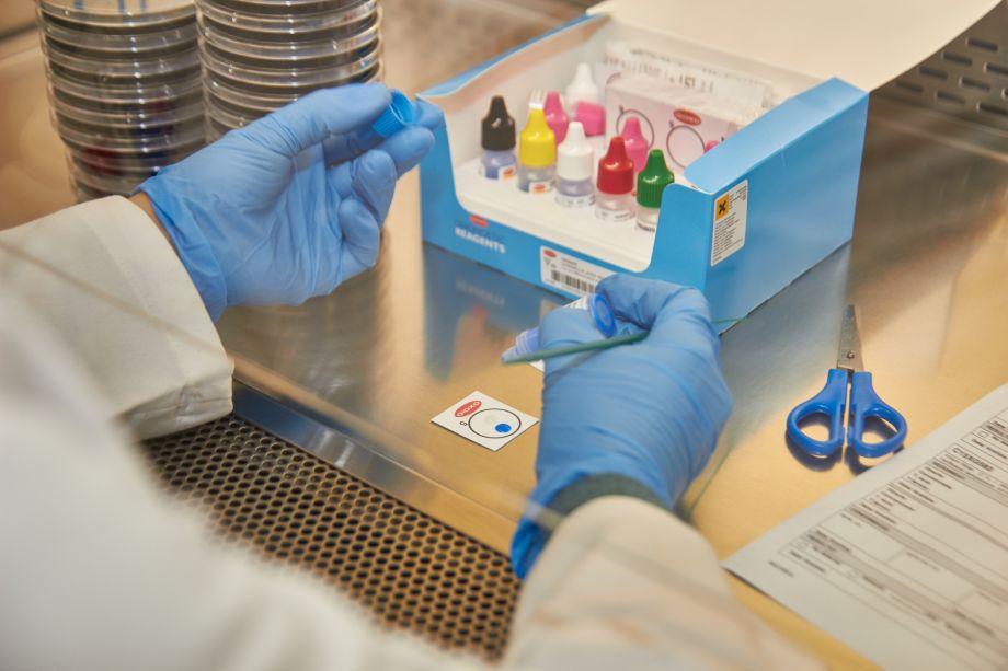 Com hem d’agafar les mostres per a detectar la legionel·la?